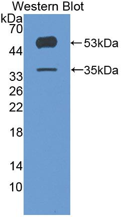Western Blot; Sample: Mouse Heart lysate; ; Primary Ab: 1µg/ml Rabbit Anti-Human ANGPTL4 Antibody; Second Ab: 0.2µg/mL HRP-Linked Caprine Anti-Rabbit IgG Polyclonal Antibody;
