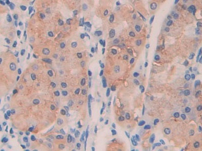 Angiopoietin Like Protein 4 (ANGPTL4) Polyclonal Antibody - image 5