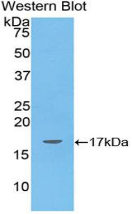 Angiopoietin Like Protein 4 (ANGPTL4) Polyclonal Antibody - image 2