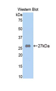 Western Blot; Sample: Lane1: Rat Serum lysate; Primary Ab: 2µg/mL Rabbit Anti-Rat a2M Antibody; Second Ab: 0.2µg/mL HRP-Linked Caprine Anti-Rabbit IgG Polyclonal Antibody;