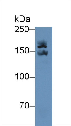 Alpha-2-Macroglobulin (a2M) Polyclonal Antibody - image 3