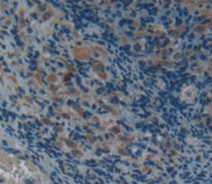 Alpha-2-Macroglobulin (a2M) Polyclonal Antibody - image 4