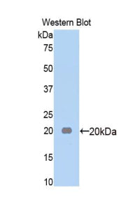 Western Blot; Sample: Lane1: Rat Serum lysate; Primary Ab: 2µg/mL Rabbit Anti-Rat a2M Antibody; Second Ab: 0.2µg/mL HRP-Linked Caprine Anti-Rabbit IgG Polyclonal Antibody;