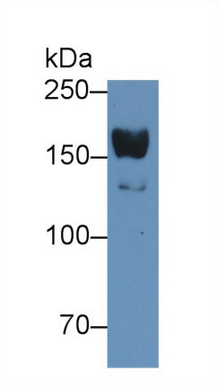 Alpha-2-Macroglobulin (a2M) Polyclonal Antibody - image 3
