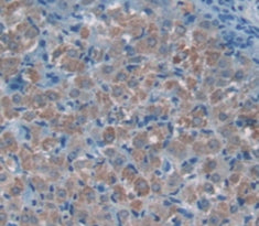 Alpha-2-Macroglobulin (a2M) Polyclonal Antibody - image 4