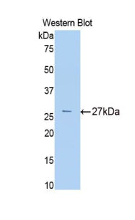 Western Blot; Sample: Lane1: Rat Serum lysate; Primary Ab: 2µg/mL Rabbit Anti-Rat a2M Antibody; Second Ab: 0.2µg/mL HRP-Linked Caprine Anti-Rabbit IgG Polyclonal Antibody;