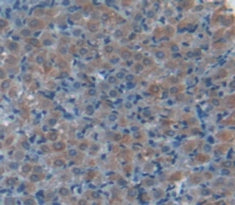 Alpha-2-Macroglobulin (a2M) Polyclonal Antibody - image 4