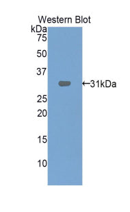 Alpha-2-Macroglobulin (a2M) Polyclonal Antibody - image 2