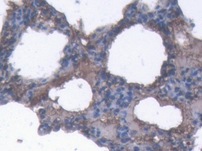 DAB staining on IHC-P; Samples: Porcine Stomach Tissue; Primary Ab: 20µg/ml Rabbit Anti-Porcine a2M Antibody Second Ab: 2µg/mL HRP-Linked Caprine Anti-Rabbit IgG Polyclonal Antibody