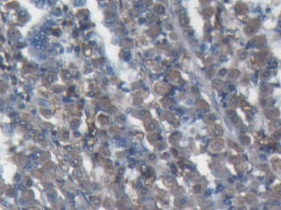 Alpha-2-Macroglobulin (a2M) Polyclonal Antibody - image 4