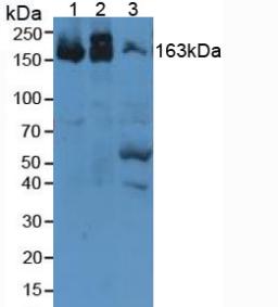 Western Blot; Sample: Recombinant a2M, Mouse.