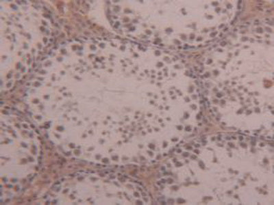 Alpha-2-Macroglobulin (a2M) Polyclonal Antibody - image 5