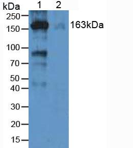 Western Blot; Sample: Lane1: Human Serum; Lane2: Human Plasma; Lane3: Human Placenta lysate; Primary Ab: 0.1µg/ml Rabbit Anti-Human a2M Antibody; Second Ab: 0.2µg/mL HRP-Linked Caprine Anti-Rabbit IgG Polyclonal Antibody;