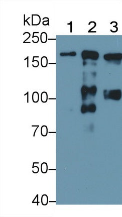 DAB staining on IHC-P; Samples: Human Liver Tissue; Primary Ab: 20μg/ml Rabbit Anti-Human a2M Antibody Second Ab: 2µg/mL HRP-Linked Caprine Anti-Rabbit IgG Polyclonal Antibody