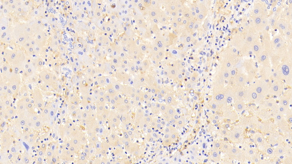 DAB staining on IHC-P. Samples: Human Tissue)