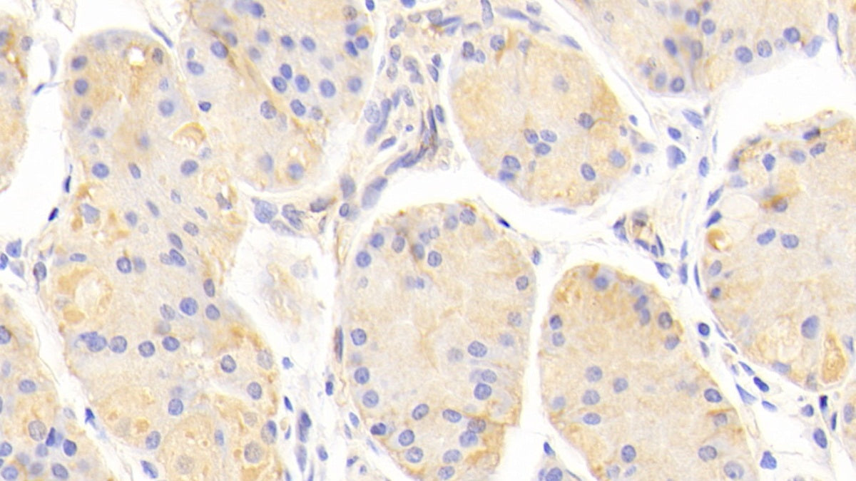 Alpha-2-Macroglobulin (a2M) Polyclonal Antibody - image 5