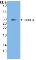 Alpha-1-Antichymotrypsin (a1ACT) Polyclonal Antibody - image 2