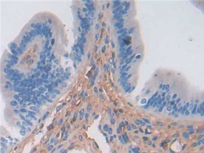 DAB staining on IHC-P; Samples: Mouse Uterus Tissue.