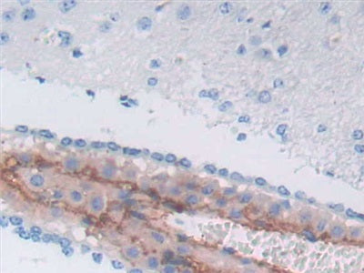 Alpha-1-Antichymotrypsin (a1ACT) Polyclonal Antibody - image 4