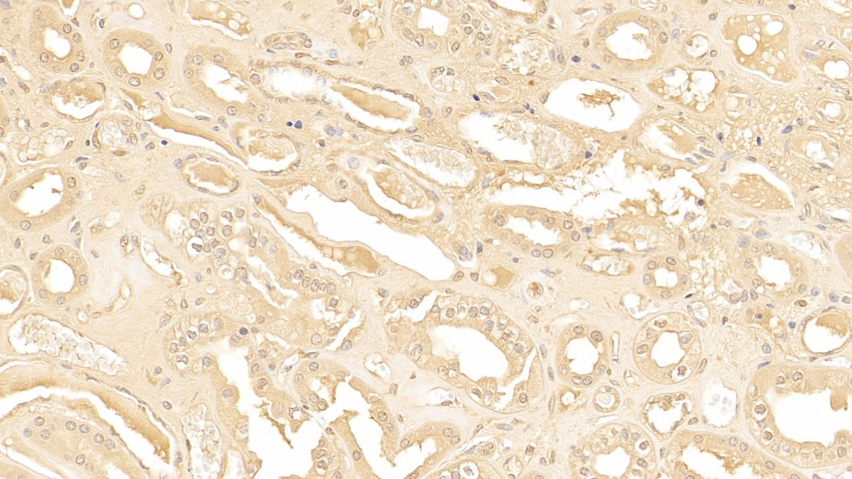 DABstainingonIHC-P.Samples:HumanTissue)