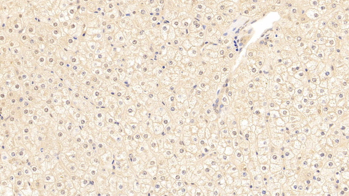 Alpha-1-Antichymotrypsin (a1ACT) Polyclonal Antibody - image 4