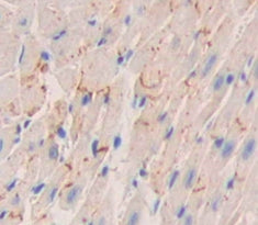 Placental Cadherin (P-cadherin) Polyclonal Antibody - image 3