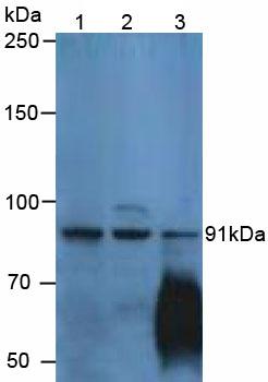 Western Blot; Sample: Recombinant CDHP, Human.