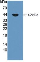 DAB staining on IHC-P; Samples: Human Liver cancer Tissue; Primary Ab: 20µg/ml Rabbit Anti-Human CDHP Antibody Second Ab: 2µg/mL HRP-Linked Caprine Anti-Rabbit IgG Polyclonal Antibody