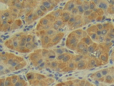 DAB staining on IHC-P;;Samples: Human Thyroid Tissue.