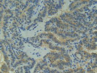 Placental Cadherin (P-cadherin) Polyclonal Antibody - image 5
