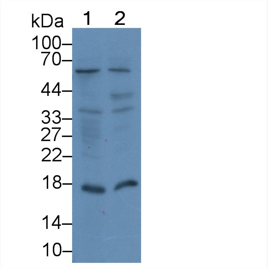 DAB staining on IHC-P; Samples: Human Adrenal gland Tissue;  Primary Ab: 10μg/ml Rabbit Anti-Human ACP1 Antibody Second Ab: 2µg/mL HRP-Linked Caprine Anti-Rabbit IgG Polyclonal Antibody