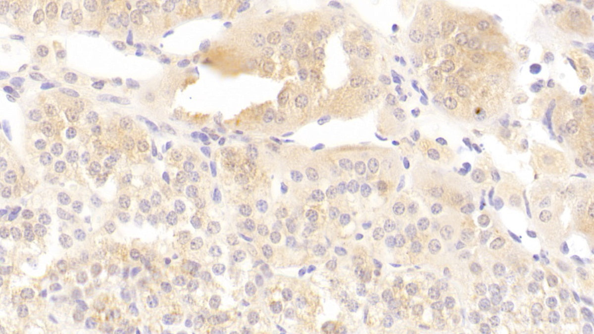 Acid Phosphatase 1 (ACP1) Polyclonal Antibody - image 4