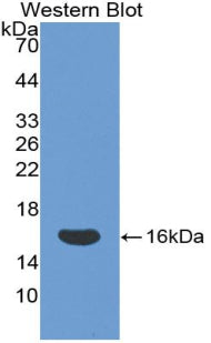 Cluster Of Differentiation 160 (CD160) Polyclonal Antibody - image 2