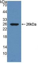 DAB staining on IHC-P; Samples: Rat Testis Tissue; Primary Ab: 30µg/ml Rabbit Anti-Rat CHRM1 Antibody Second Ab: 2µg/mL HRP-Linked Caprine Anti-Rabbit IgG Polyclonal Antibody