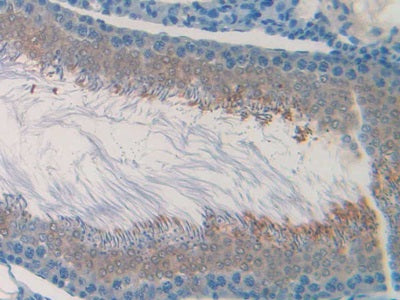 DAB staining on IHC-P; Samples: Rat Kidney Tissue.