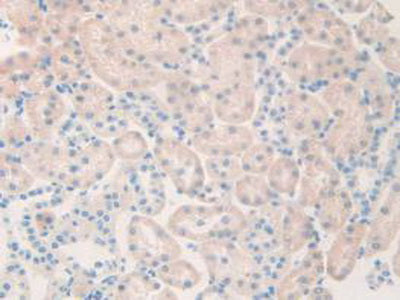 Cholinergic Receptor, Muscarinic 1 (CHRM1) Polyclonal Antibody - image 5
