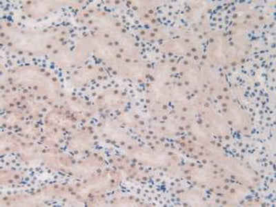 Endoglin (ENG) Polyclonal Antibody - image 5