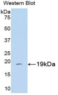 DAB staining on IHC-P; Samples: Human Cerebrum Tissue; Primary Ab: 20μg/ml Rabbit Anti-Human CYPA Antibody Second Ab: 2µg/mL HRP-Linked Caprine Anti-Rabbit IgG Polyclonal Antibody