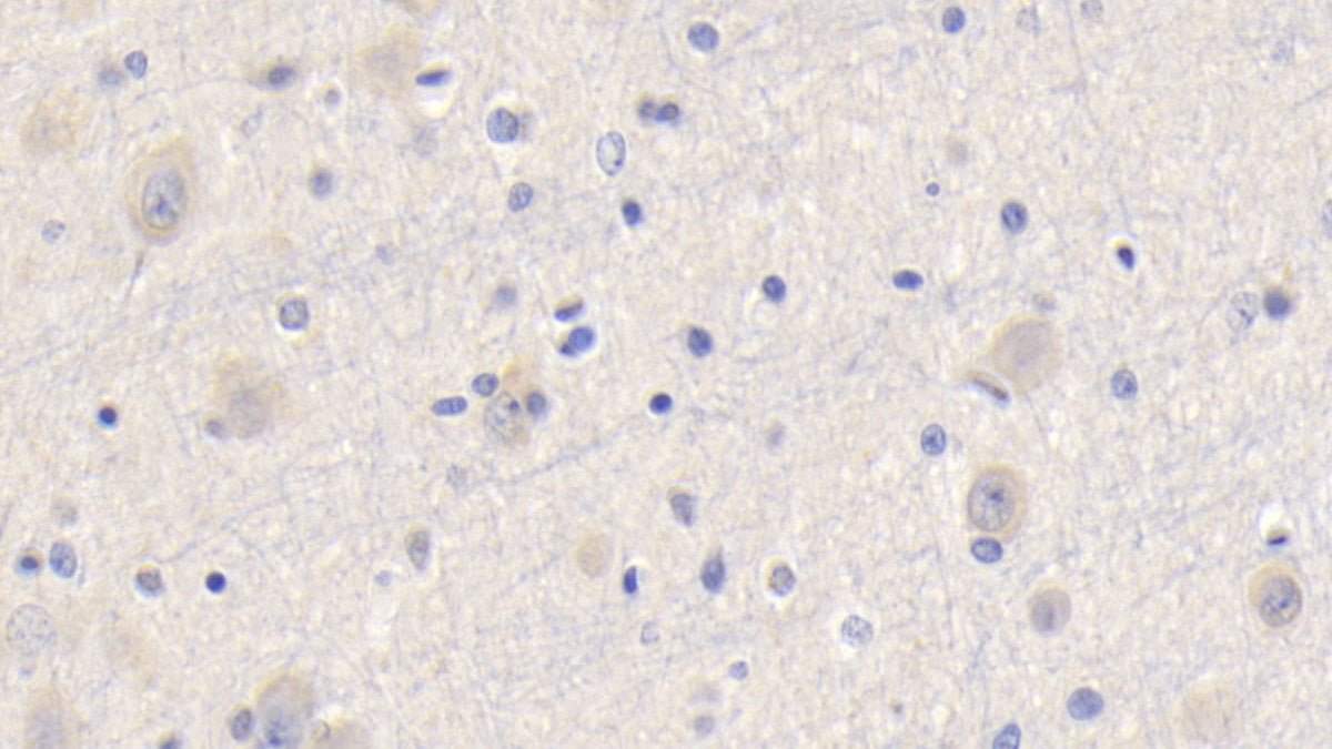 DAB staining on IHC-P. Samples: Human Tissue)