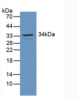 Western Blot; Sample: Recombinant RGS4, Human.