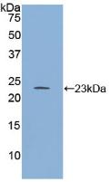 Regulator Of G Protein Signaling 4 (RGS4) Polyclonal Antibody - image 3