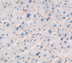 Regulator Of G Protein Signaling 4 (RGS4) Polyclonal Antibody - image 4