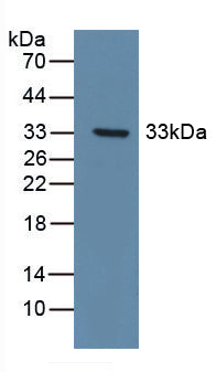 DAB staining on IHC-P; Samples: Human Liver Tissue; Primary Ab: 10µg/ml Rabbit Anti-Human DDR1 Antibody Second Ab: 2µg/mL HRP-Linked Caprine Anti-Rabbit IgG Polyclonal Antibody