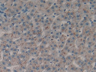 DAB staining on fromalin fixed paraffin- embedded liver tissue)