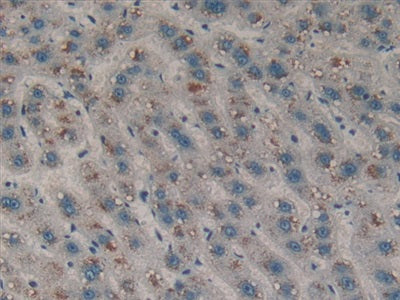Discoidin Domain Receptor Family, Member 1 (DDR1) Polyclonal Antibody - image 5