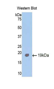 Activin A Receptor Type I (ACVR1) Polyclonal Antibody - image 2