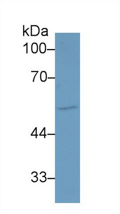 Western Blot; Sample: Recombinant protein.