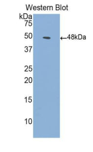DAB staining on IHC-P; Samples: Human Cardiac Muscle Tissue;  Primary Ab: 20μg/ml Rabbit Anti-Human ACVR1 Antibody Second Ab: 2µg/mL HRP-Linked Caprine Anti-Rabbit IgG Polyclonal Antibody
