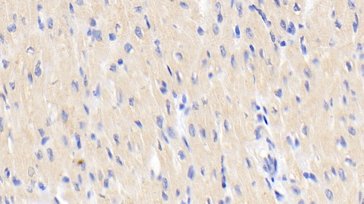 Activin A Receptor Type I (ACVR1) Polyclonal Antibody - image 4