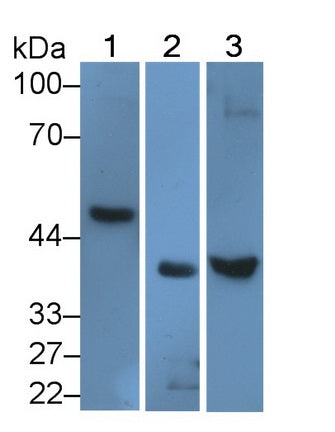 DAB staining on IHC-P; Samples: Human Cardiac Muscle Tissue;  Primary Ab: 20μg/ml Rabbit Anti-Human ACVR1 Antibody Second Ab: 2µg/mL HRP-Linked Caprine Anti-Rabbit IgG Polyclonal Antibody